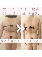 トータルビューティージュネス(JEUNESSE)/-20kg!ここまで変われます♪