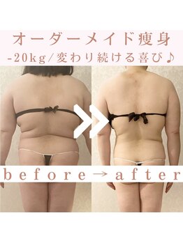 トータルビューティージュネス(JEUNESSE)/-20kg!ここまで変われます♪