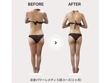 ビループ(biloop)/《短期痩せ》驚きの変化を♪