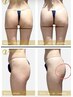 《腰回りSET》腸もみマッサージ＋ビジリス骨盤底筋(15分)　¥6,500