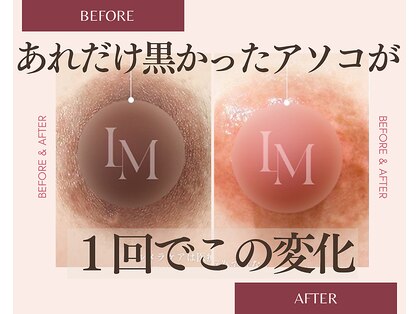 モア(more.)の写真