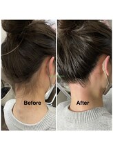 サロン ジプソ(salon Gypso.)/うなじダブル脱毛