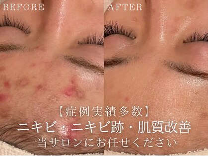 フォーウーマン(for woman)の写真