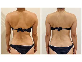 TMサロン 赤坂/ガチガチ肩さよなら！