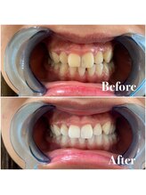 ライトビューティー 池袋店(LightBeauty)/症例写真