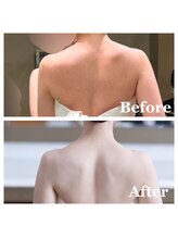 ライズ/お客様のビフォーアフター 