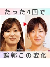 ロコモ 美容矯正サロン(Locomo)/左右対称の小顔：週1回×4回