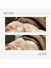 ラグレ(LUXRE)/バストケア