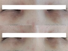 ヴェルシック(Belchic)の雰囲気（【絶対美白が叶う復元フェイシャル】福井で唯一瞼のお悩みも改善）