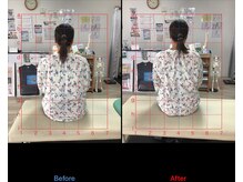 ストレチックス 近江八幡店/姿勢改善ビフォーアフター1回