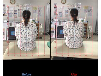 ストレチックス 近江八幡店/姿勢改善ビフォーアフター1回