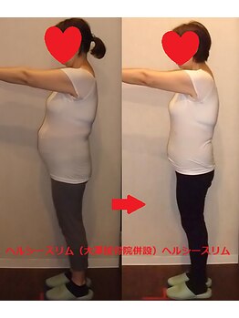 ヘルシースリム 大澤接骨院/