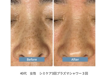 ビジュツ(BIJYUTSU)/