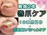 【巻爪２本・１０本爪切り・爪育成ケアスペシャル】