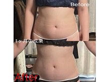 キートス(Kiitos)の雰囲気（細胞レベルで気になる部位超燃焼!小顔/ボディ/痩身）