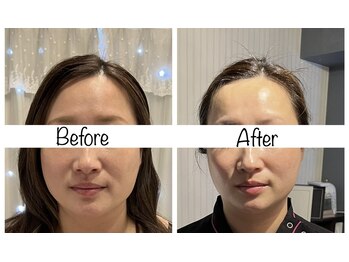 ビューティーサロン リリー(Lily)/