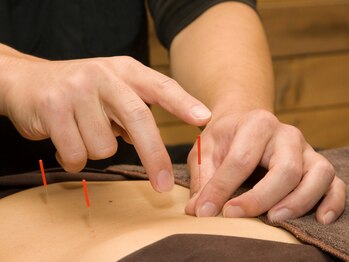 上毛鍼灸院/鍼灸