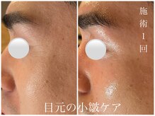 ダン(dan)/【陶肌トリートメント】症例