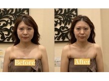 アジール 長岡リバーサイド千秋店(agir)/before/after画像