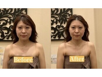 アジール 長岡リバーサイド千秋店(agir)/before/after画像