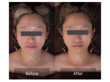 レーヴリゼ(Revelise)/頭蓋骨小顔矯正＋整顔マッサージ