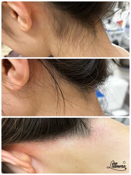 サロンエム 西荻窪(salon M)/うなじワックス