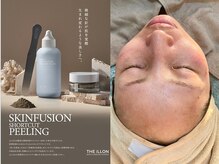 コンフィ(Comfy)/韓国ハーブピーリング