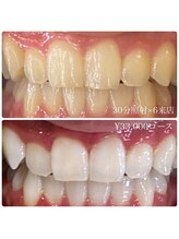 ホワイトニングルーム 横浜店(Whitening Room)/ホワイトニング/横浜