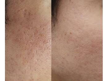 エスポワール(espoir)/before・after