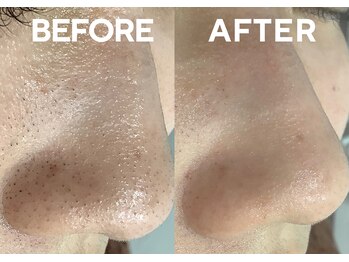 ベベ 高崎本店(Be'be')/Before After