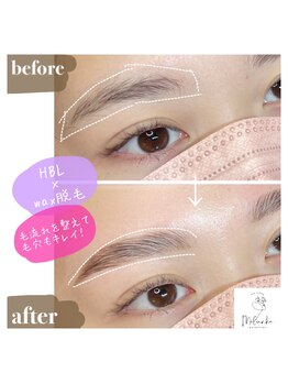 モルンカ 松山(Molunka)/