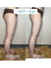 アンド ジョイ(&JOY)/美脚美尻集中フルコース施術例☆