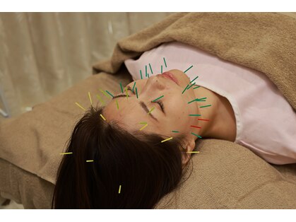 アラシ(Arashi)の写真