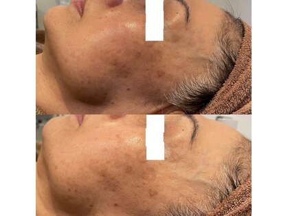 ローズマリー(rosemary)の写真