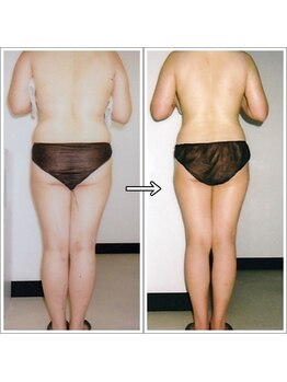 ルッチョラ(Lucciola)/ビフォーアフター