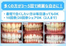 ホワイトニングショップ 水戸駅前店