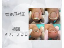 ネイルサロン リアン西葛西店の雰囲気（巻き爪補正）
