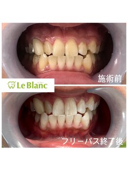 ルブラン 奈良店(Le Blanc)/たくさん通ってお得に！