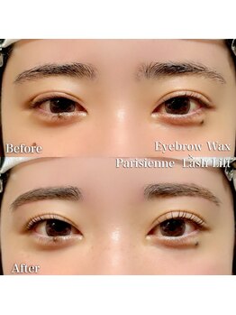 リノン(Linon)/セットでお得!