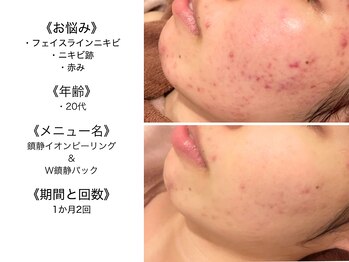 アクール(Accueil)/男性のお客さまも大歓迎です!