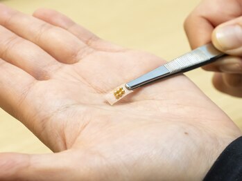 にこ鍼灸治療院の写真/【実績多数◎】耳つぼ施術と栄養・食事指導で短期ダイエット★痩せにくい・リバウンドする等のお悩みにも♪