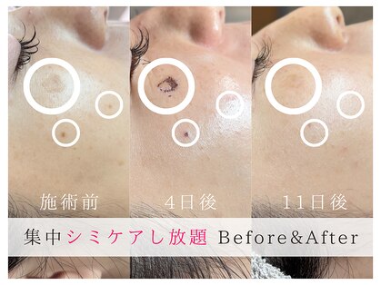 ルミラポー(Lumira Peau)の写真