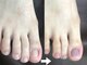 キュアネイル(Qa Nail)の写真/足の深爪でお悩みの方へ！サンダル前の集中ケアで、理想の指先を叶えるお手伝いを致します♪