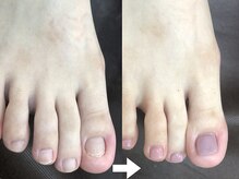 キュアネイル(Qa Nail)