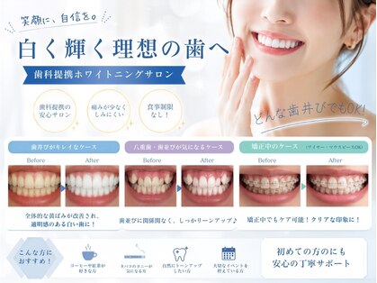 セルフメイドホワイトニングの写真