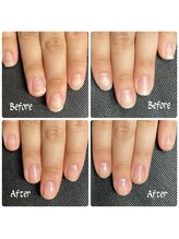 ルームイチマルイチネイルズ(Room101Nails.)/自爪育成・最強のネイルケア鳥取