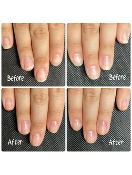 ルームイチマルイチネイルズ(Room101Nails.)/自爪育成・最強のネイルケア鳥取