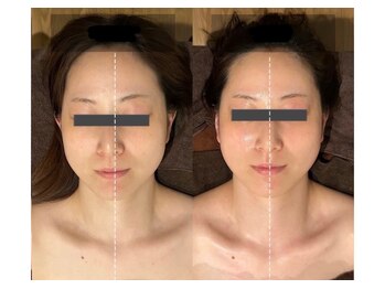 レーヴリゼ(Revelise)/頭蓋骨小顔矯正+整顔マッサージ