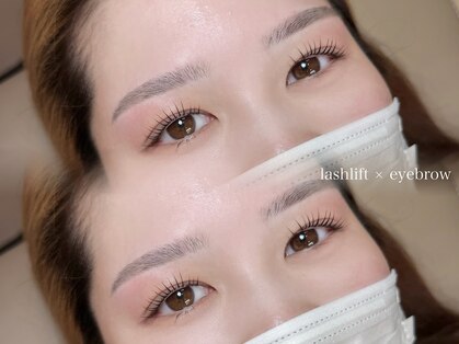 イオナ(IONA)の写真