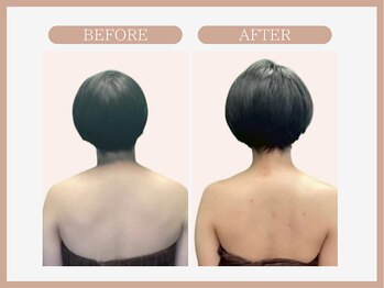 スリムライン 青森店(The Slim Line)/before→after